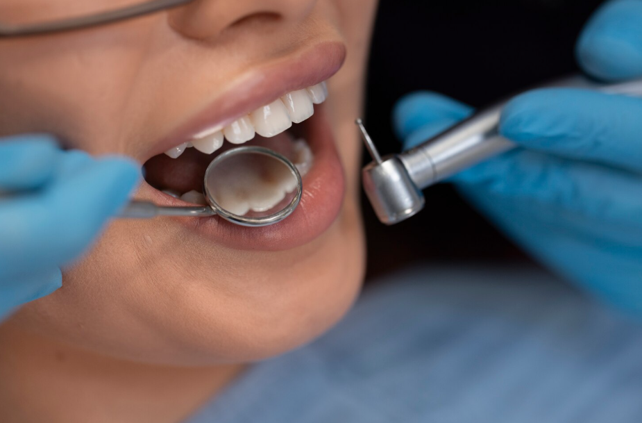 Root Canal Treatment