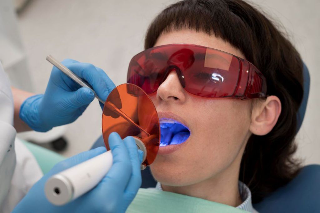 Dental Fillings