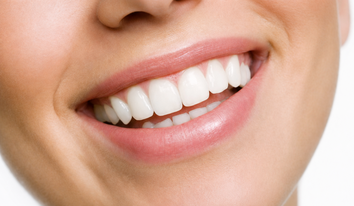 Teeth Whitening in Guelph