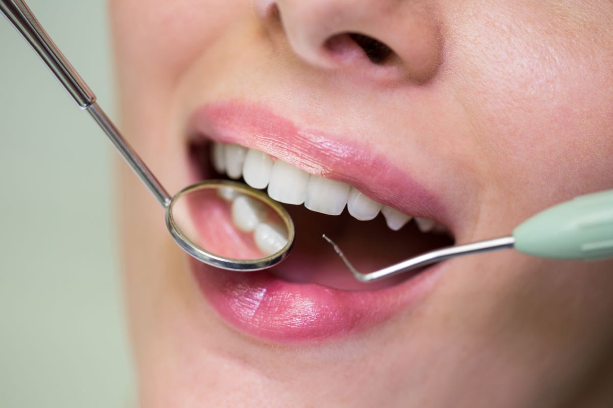 Dental Exam in Waterloo