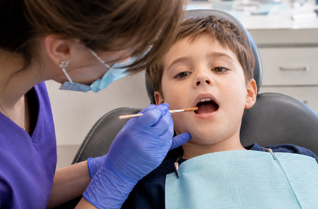Dental Sealants at Aroma Dental in Humble, TX: a dentist applying protective sealant into the deep grooves of a child's molar
